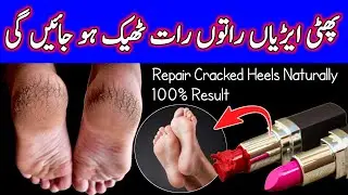 Cracked Heels Gone in 1 Night with Vaseline & Gur DIY Trick for Cracked Heels That Actually Works