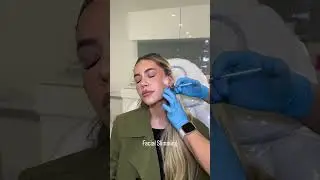💉Watch the magic of Facial Slimming with BOTOX