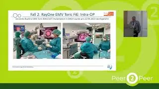 Peer2Peer | Professor Auffarth spricht &uuml;ber die RayOne EMV Toric