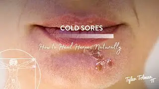 Cold Sores | How to Heal Herpes Naturally