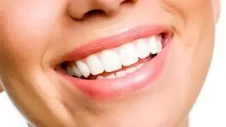 Teeth Cleaning And Whitening In Bristol