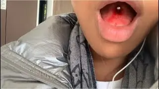 Zungenpiercing Heilung Tag 1-14 👅 | KARA GROTH