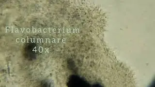 Columnaris (Falvobacterium columnare): Wet Mount of Fish Skin Scrape