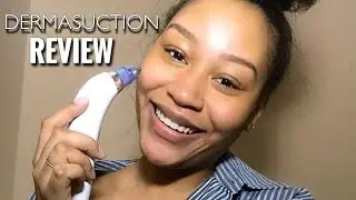 DermaSuction Review | Does it really work!? | Gabrielle LaFaye&rsquo;