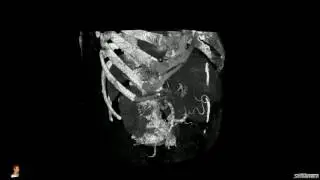 Segmenter DICOM Viewer
