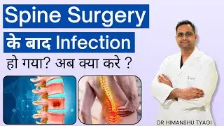 Spine Surgery के बाद Infection हो गया? Infection after spine surgery | Treatment 