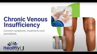 Vein Health at HealthyU Clinics