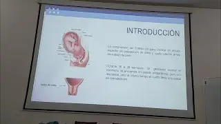 Obstetrics / Physiology and mechanism of vertex presentation delivery / Spanish