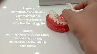 #dental#Doctor Bhaskar's Elite Dental #aligners#braces#crowded#good dentist 