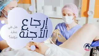 هل عملية إرجاع الأجنة عملية مؤلمة؟ | Embryo Transfer