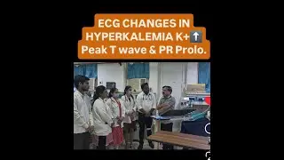 #drabhishekshukla #hyperkalemia #ecgtest #ECGChanges #cardiacemergency #peaked #twave #bradycardia