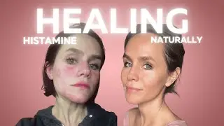 The Anti-Inflammatory Foods That Saved Me (What I Eat in a Day - MCAS, Mold, Viral Load)