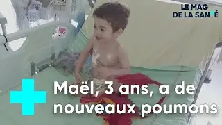 Greffe des poumons : un second souffle pour Ma&euml;l, 3 ans - Le Magazine de la Sant&eacute;