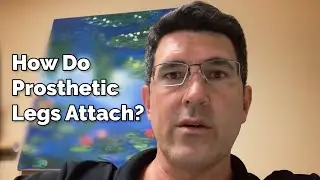 How Do Prosthetic Legs Attach?