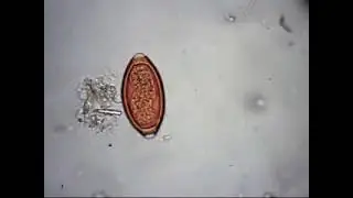 trichuris trichiura y ascaris lumbricoides   YouTube