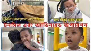 আমার ছেলের টনসিল এবং অ্যাডিনয়েড সার্জারি A TO Z সব কিছু || Tonsil and Adenoid Surgery in Apollo.