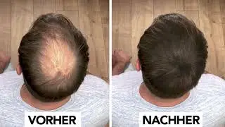 IMPERIO Streuhaar - Volles Haar in 20 Sekunden!