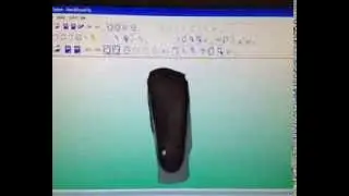 3d scanner orthotics example - Active Care Podiatry Capalaba