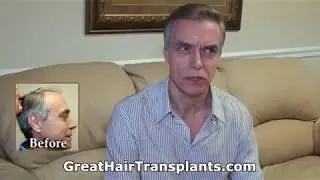 Best Hair Transplant & Restoration Techniques In South San Francisco, California -  Dr. Brett Bolton