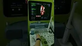 Voluson P8 HDlive & Magicut