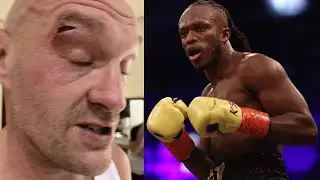 Tyson Fury Pulls Out Just Two Weeks Before His Fight!