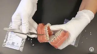 Votion Buccal Tubes | Ortho Technology