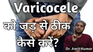 Varicocele का  इलाज ।कैसे इसे जड़ से ठीक करें।Varicocele Treatment
