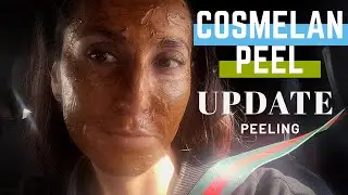 Cosmelan Peel update the peeling