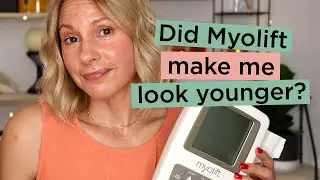 Myolift Mini 60-Day Results - Before & After Photos | Skin Obsessed Mary