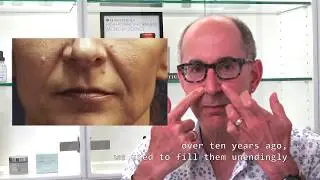Dr Frame Talks Nasolabial Folds