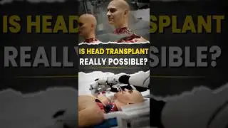 Head Transplant: Brain Bridge #artificalintelligence