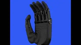 Perfect solution for upper limb amputees | Bionic hand by Aether Biomedical