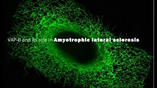 Sima Lev: VAP-B and its role in Amyotrophic lateral sclerosis
