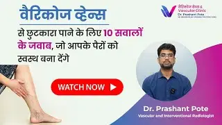 Varicose Veins Your Top 10 Questions Answered  | By Dr. Prashant Pote