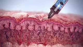 Sculptra Collagen Stimulation Explained | How Sculptra Works | Embrace Eternal Beauty