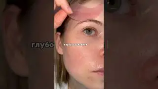 Все оценили эти патчи с коллагеном ￼🤩 арт.WB: 41002668 ДО