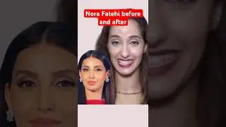 Nora Fatehi before and after plastic surgery #norafatehi #nora #yoyohoneysinghnewsong   #payal