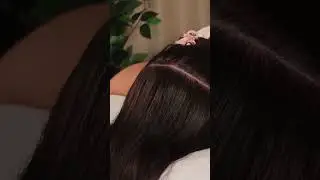 Ultimate ASMR Exam of RED SPOTS on SCALP with Treatment #asmr #short #shorts