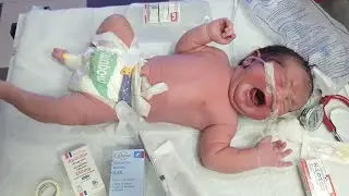 Newborn Initial Assessment & First IV Medication Administration#newborn#nicucare#cute Baby#nicubaby 