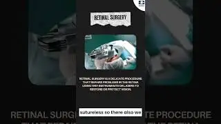 Discover the Latest Innovations in Eye Surgery That Are Transforming Vision Care!