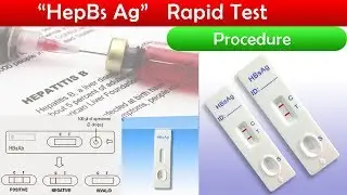 HepBs Ag test Procedure ( clear explain )