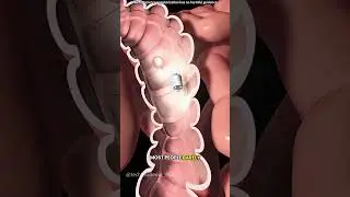Capsule Endoscopy #adventure #anatomy #3danimation #music #doctor #animation #relaxingmusic