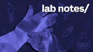 Lab Notes | Fire Inside: The quest to understand & prevent rheumatoid arthritis.