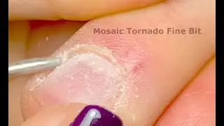 Mosaic Diamond Tornado Bit