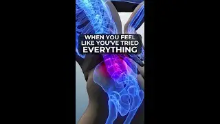 Avoid Foot Drop Surgery: Discover Disc Renewal Therapy for Nerve Health #footdrop #spine