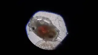 Rotifer Eating Daphnia.wmv