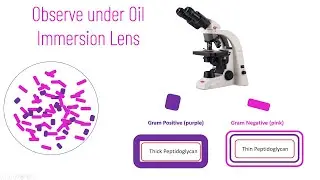 Gram Staining Principle and Procedure