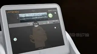 Ulthera ST1 BHCP