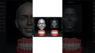 INSTARISA 3.0 3D Facial Scanner: Precision in Dental Imaging