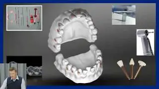 Webinaro i&scaron;trauka: teeth straightening aligner. Where to start?
